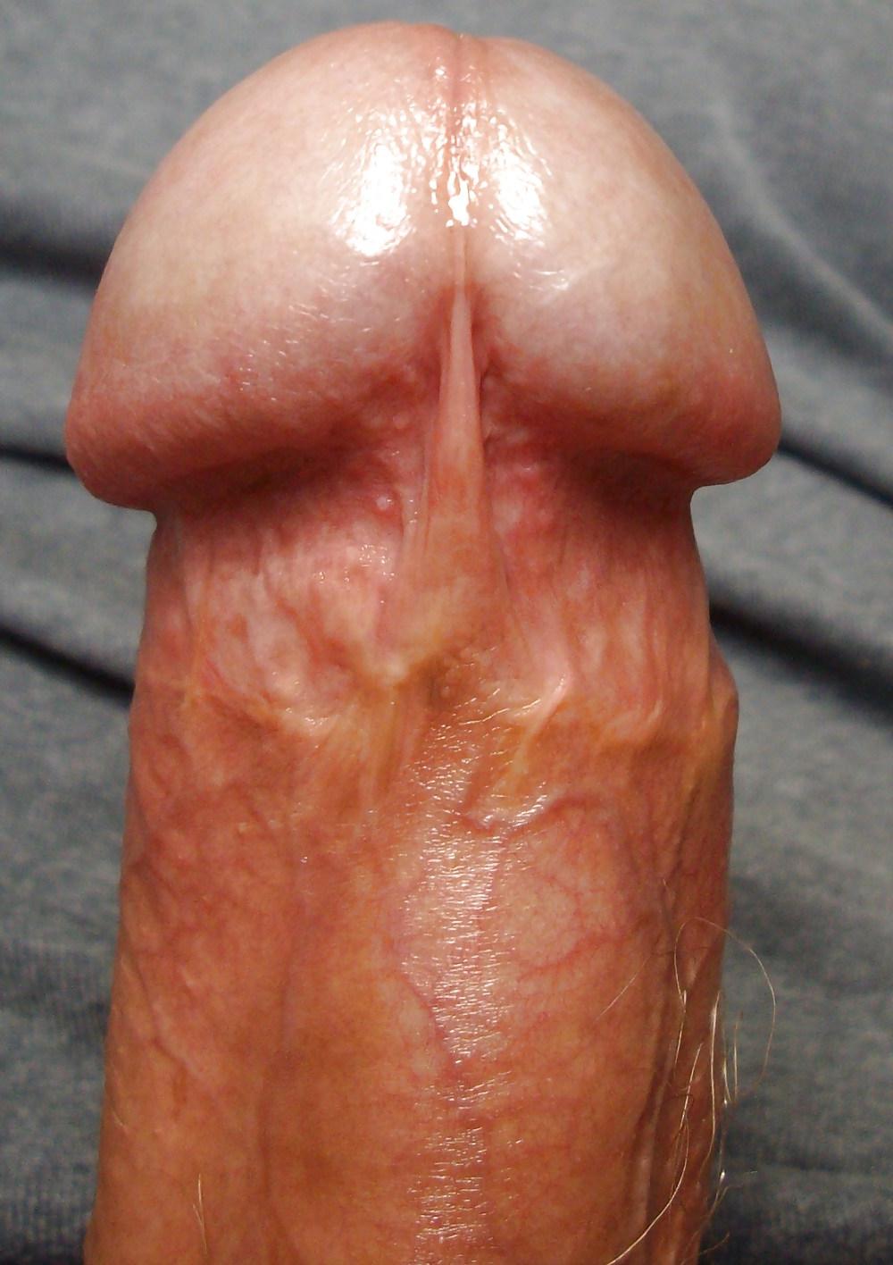 11P FRANK'S HUGE COCK: Detail of Head