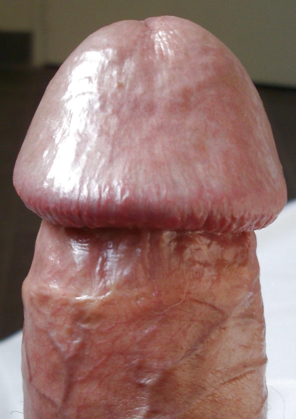 11P FRANK'S HUGE COCK: Detail of Head