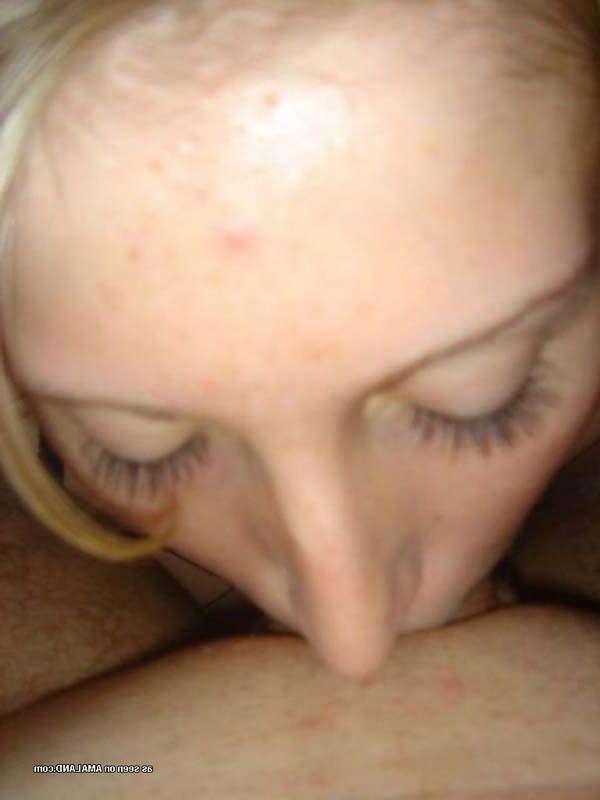 15P GFs giving head