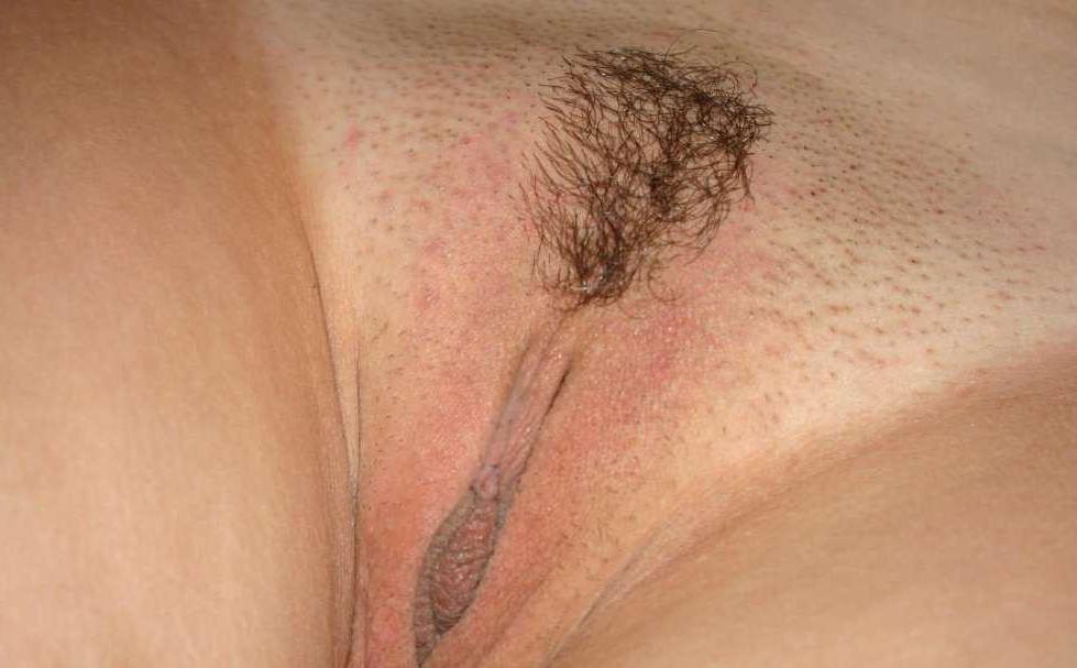 15P Frau mit versautem Haar