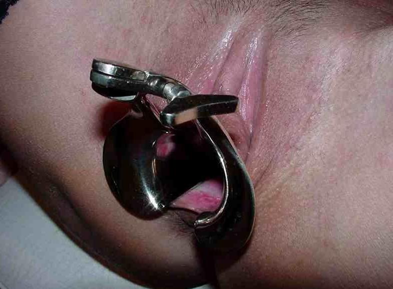 16P extreme homemade pussy and anal insertions