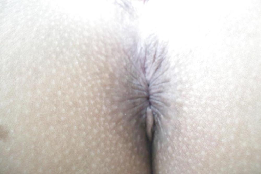25P Ass&Anus