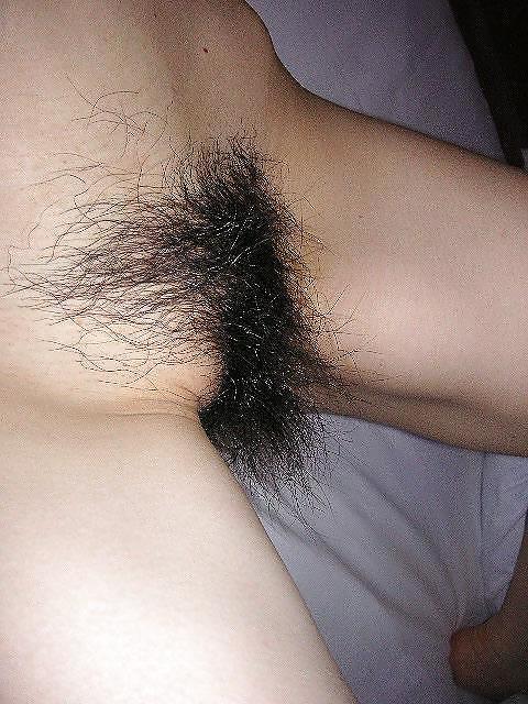 25P Thick Hairy Bushes