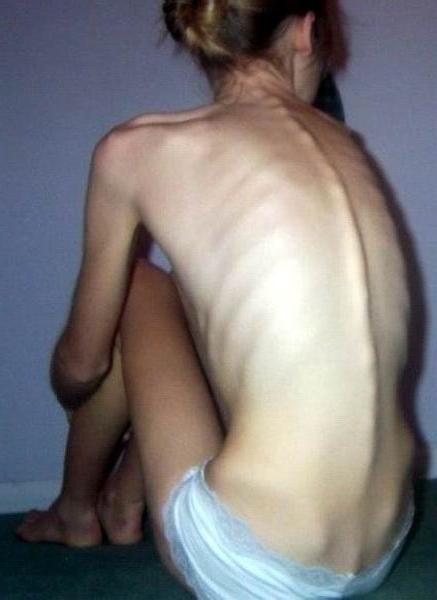 12P very skinny girls showing off their bones