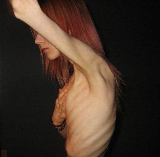 12P very skinny girls showing off their bones