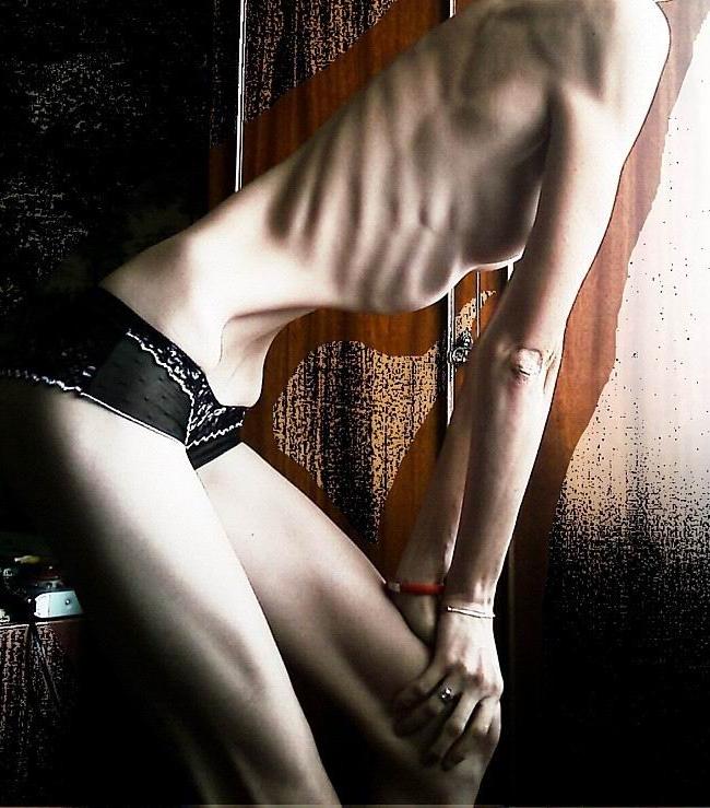 12P very skinny girls showing off their bones