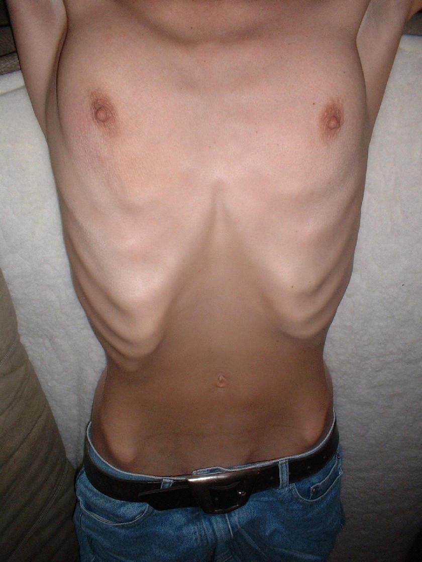 12P very skinny girls showing off their goodies