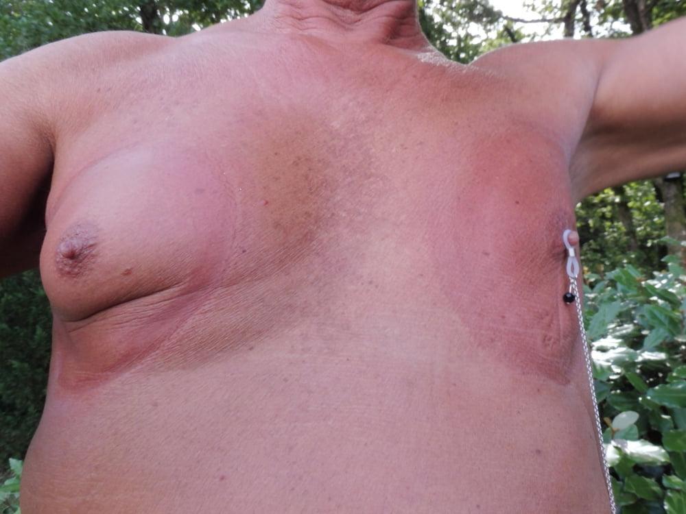 25P Mes Tetons Apres Pompe a seins et Pinces