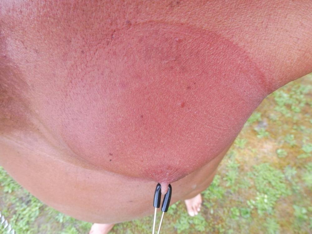 25P Mes Tetons Apres Pompe a seins et Pinces