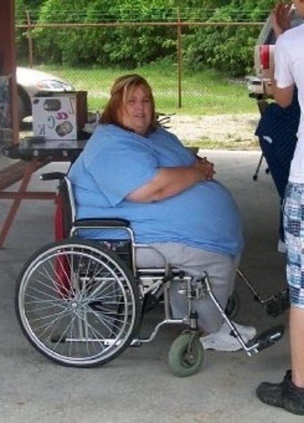 25P SSBBW Immobilised By Fat
