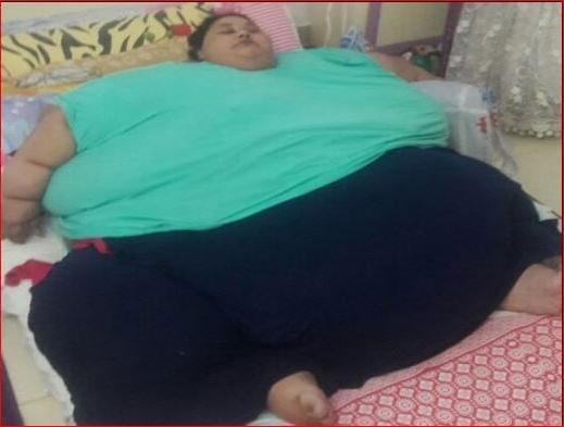 25P SSBBW Immobilised By Fat
