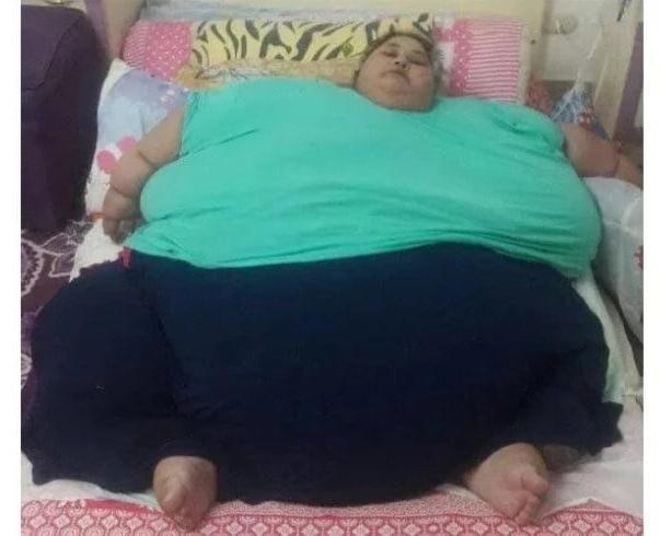 25P SSBBW Immobilised By Fat