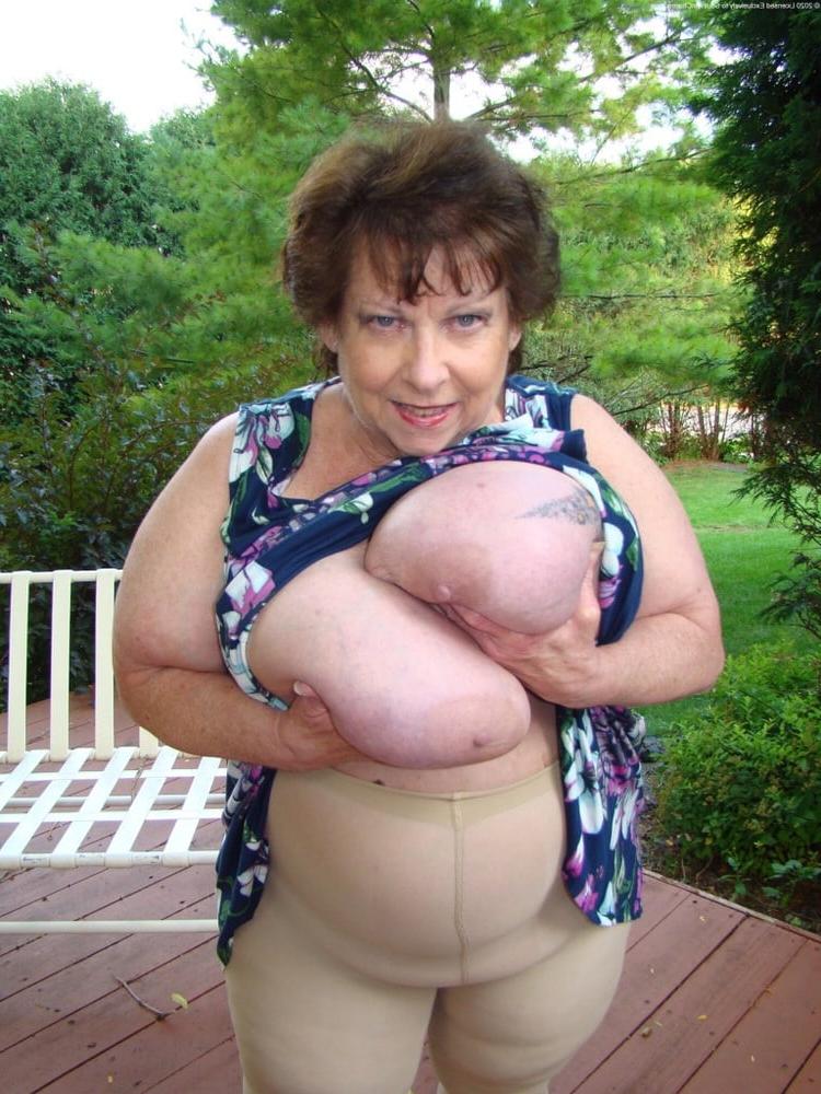 25P Hoodyman ssbbw 352 . Fat Retard Linda Dayton .