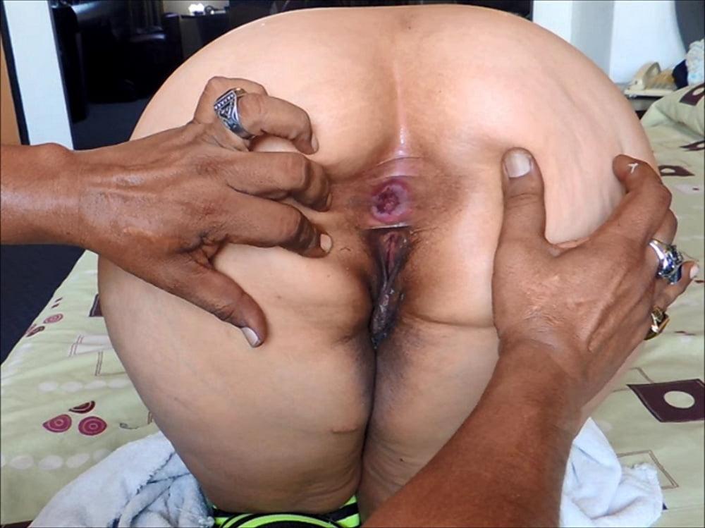 25P Georgeus Anus 04