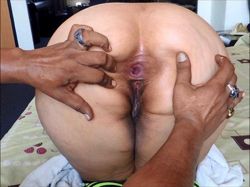 25P Georgeus Anus 04