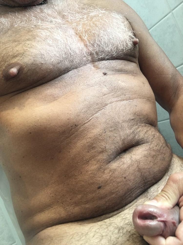 15P My body