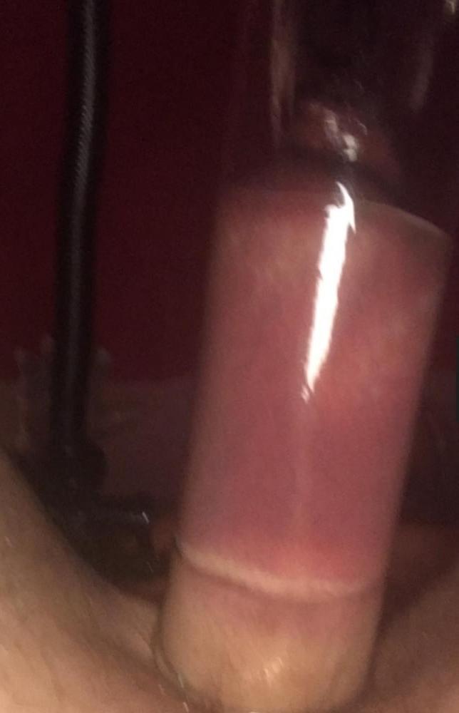 25P Fetish