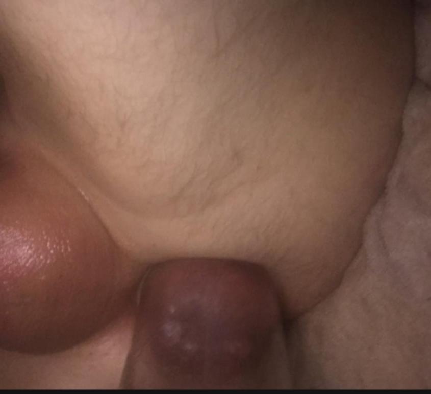 25P Fetish