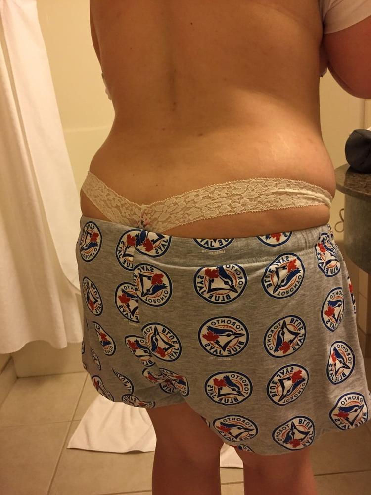 25P Thong exposed