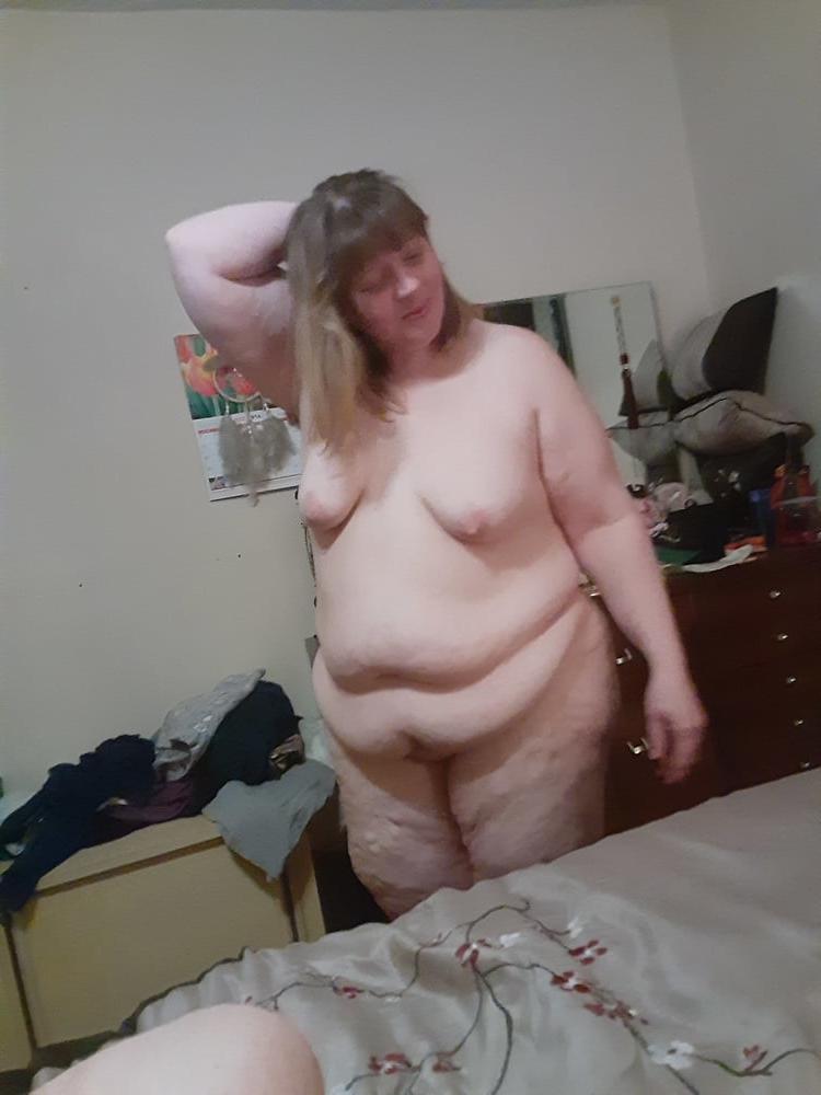 25P HHoodyman SSBBW 350 . World Sickness pervert fat babes .