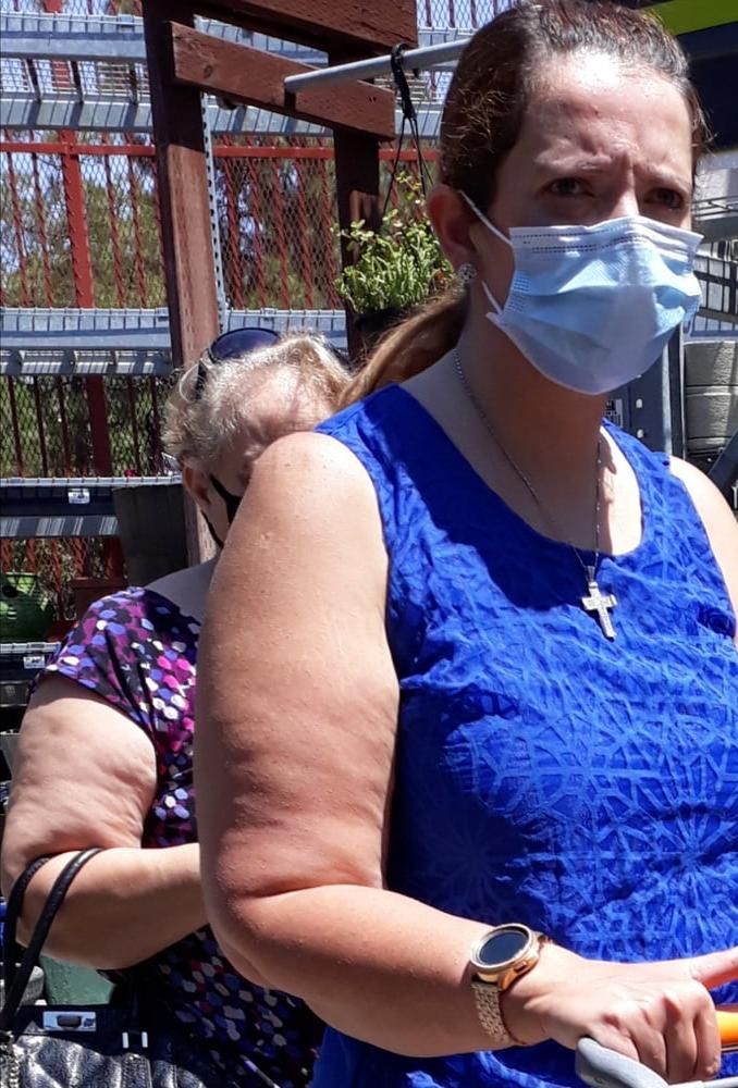 25P cellulite sluts 2 . very fat arms, flabby ass, cellulite leg