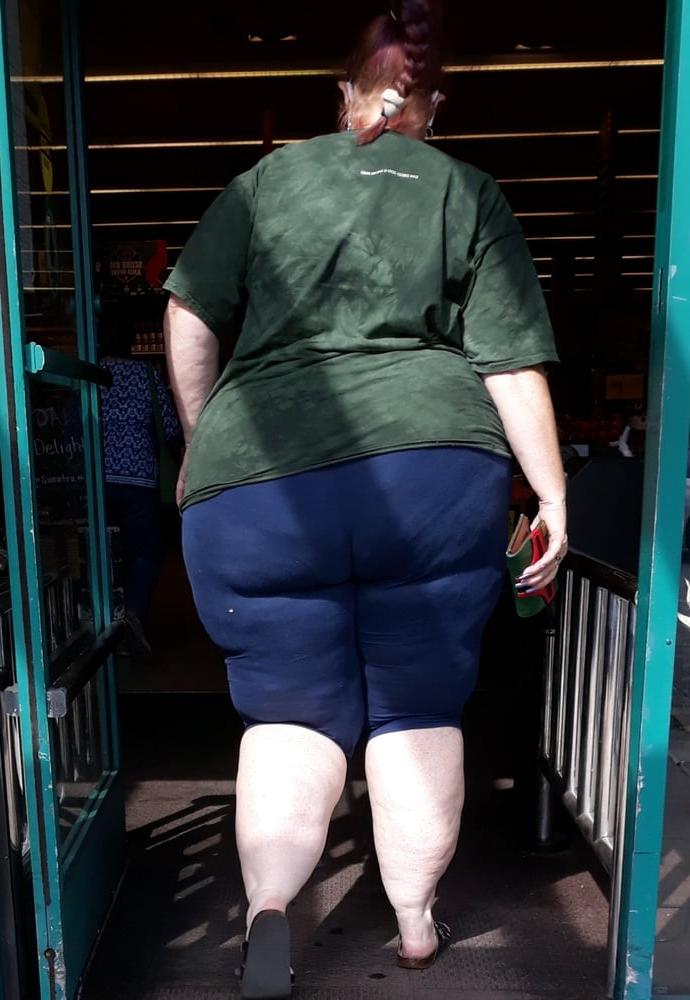 25P cellulite sluts 2 . very fat arms, flabby ass, cellulite leg