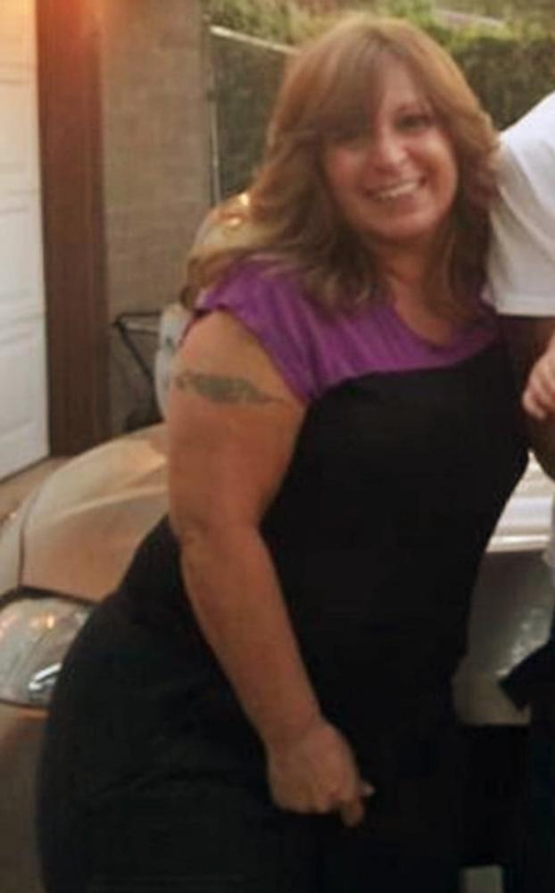 25P cellulite sluts 2 . very fat arms, flabby ass, cellulite leg