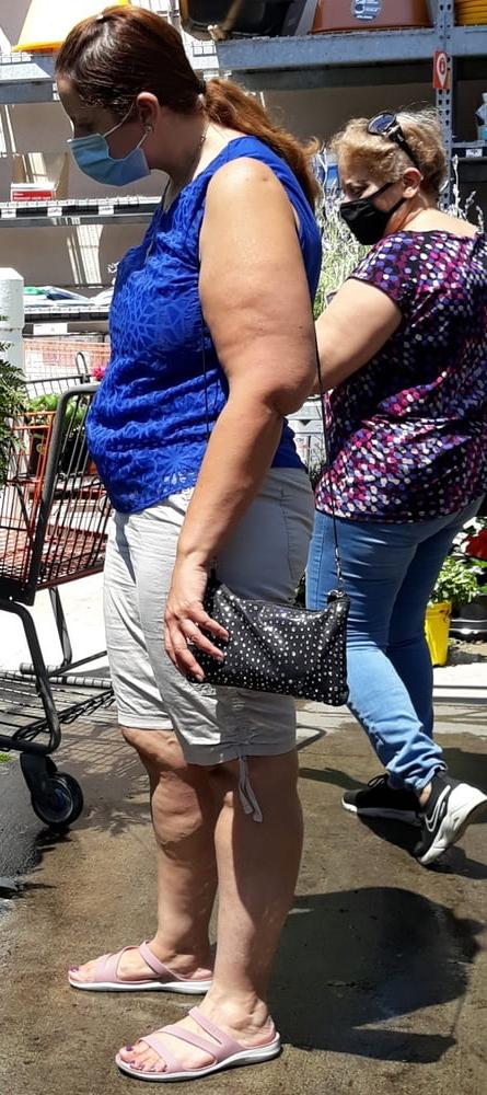 25P cellulite sluts 2 . very fat arms, flabby ass, cellulite leg