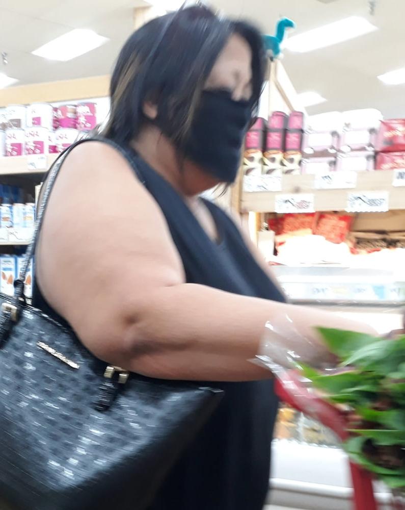25P cellulite sluts 2 . very fat arms, flabby ass, cellulite leg