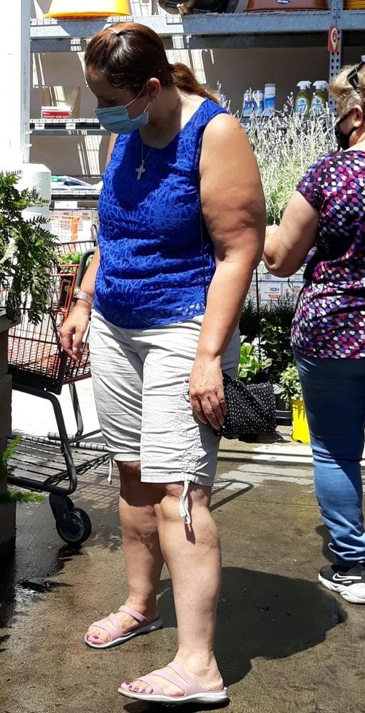 25P cellulite sluts 2 . very fat arms, flabby ass, cellulite leg