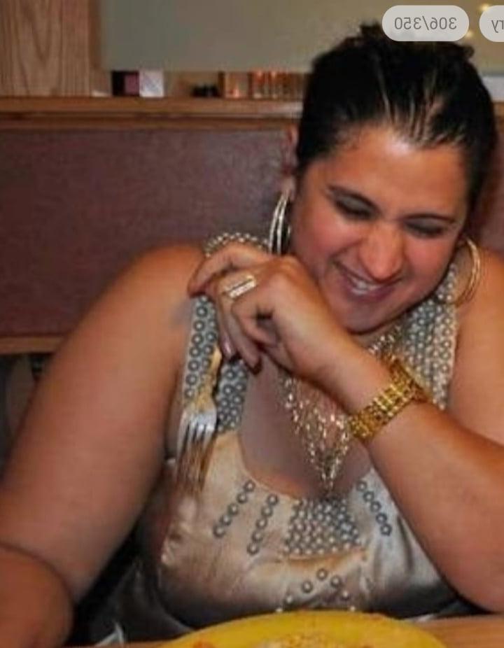 25P cellulite sluts 2 . very fat arms, flabby ass, cellulite leg