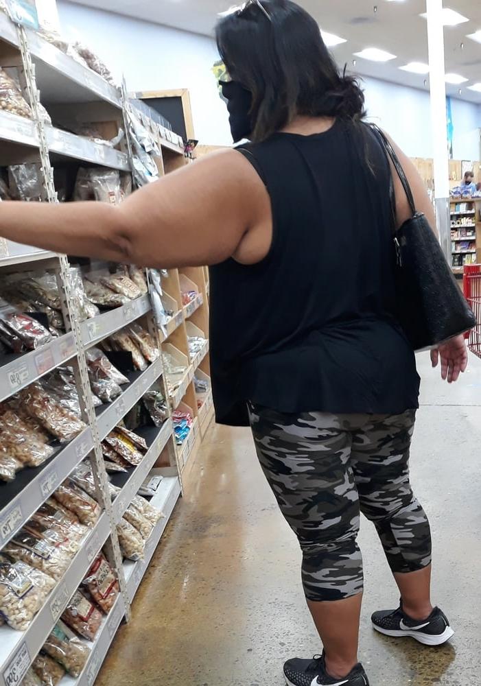 25P cellulite sluts 2 . very fat arms, flabby ass, cellulite leg