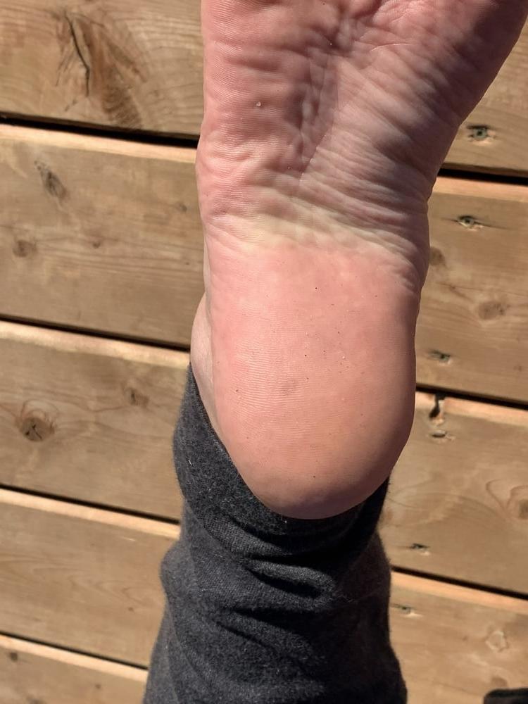 22P perfect feet and soles