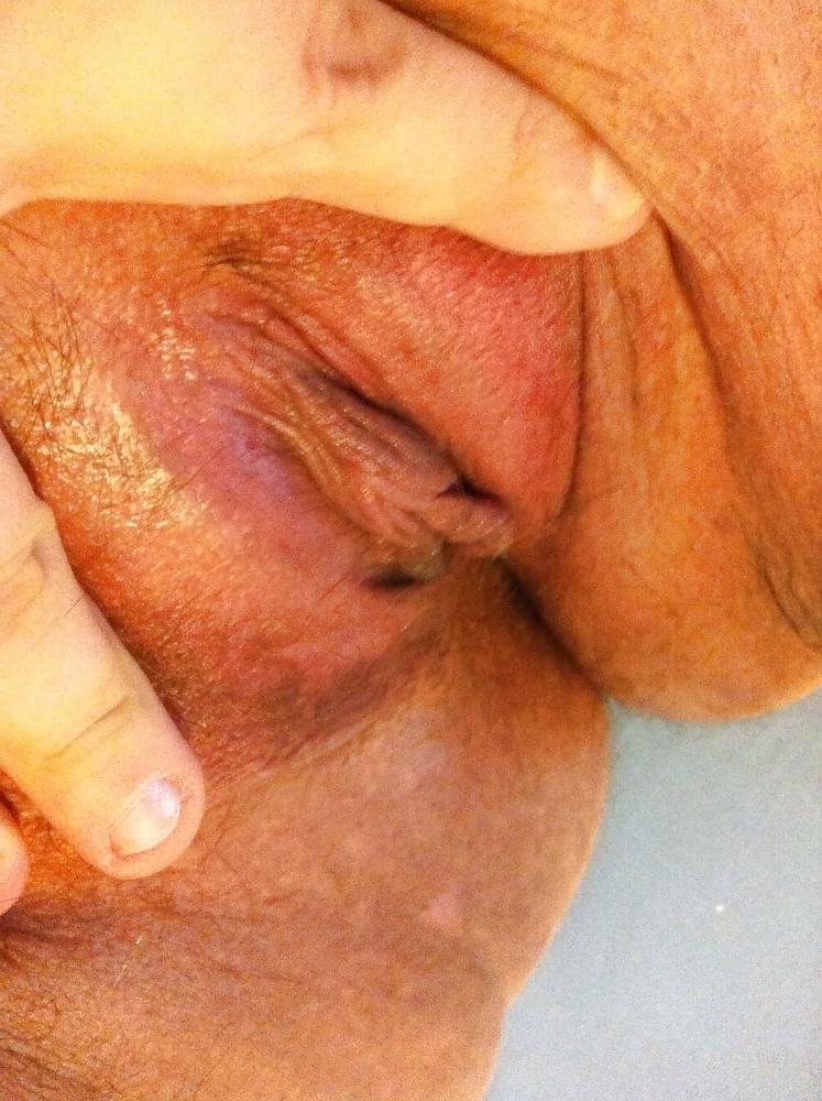 25P Spreading my fat sweet pussy