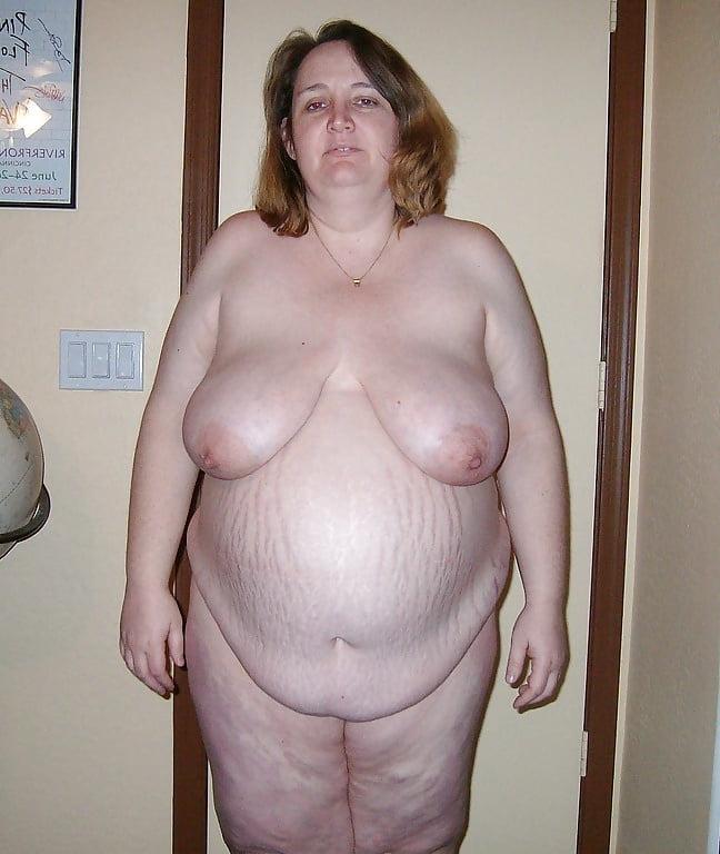 25P fat and preg