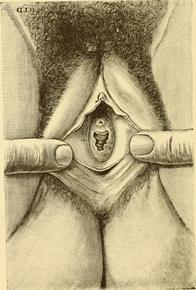 25P Black &amp; White Erotic Art - 9