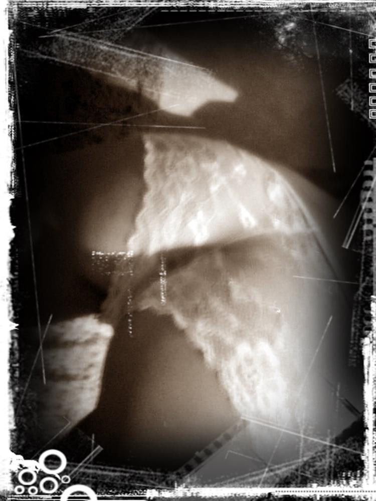 14P ARTISTIC IMAGES 3