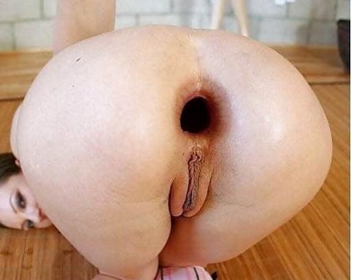 22P Used anus