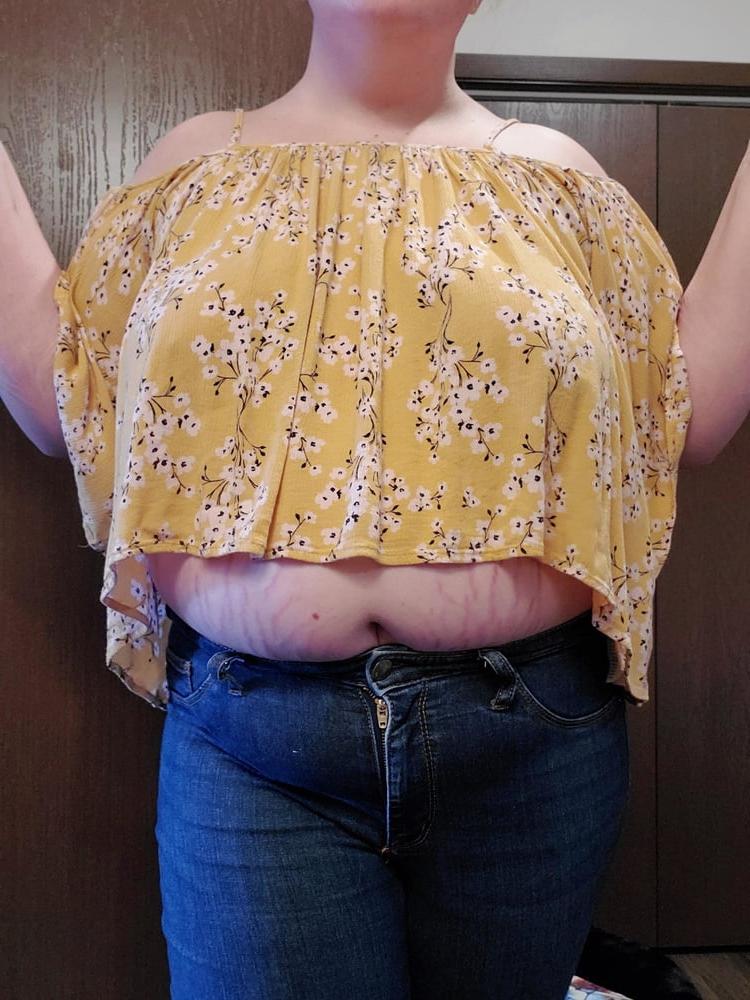 25P BBW Nice Flabby Fat Girls