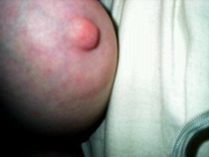 25P Ugly Pig Wife Chris shows her saggy boobs