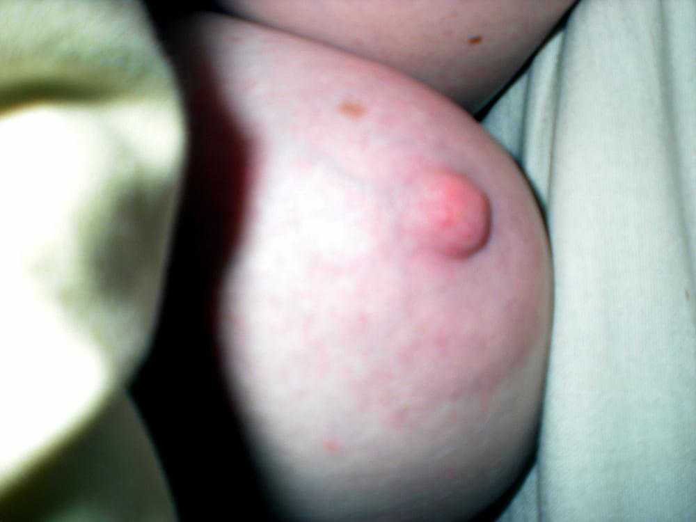 25P Ugly Pig Wife Chris shows her saggy boobs