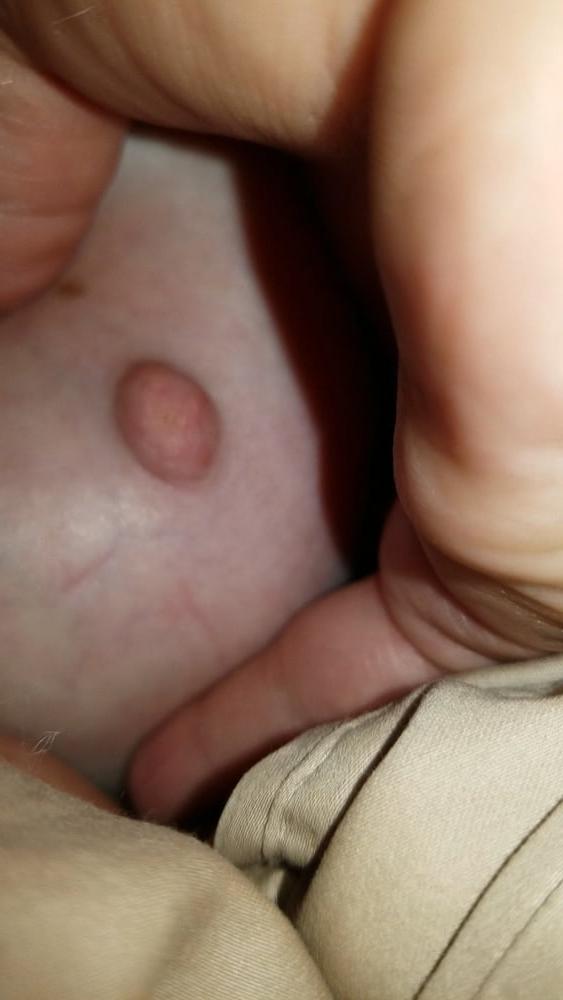 25P Ugly Pig Wife Chris shows her saggy boobs
