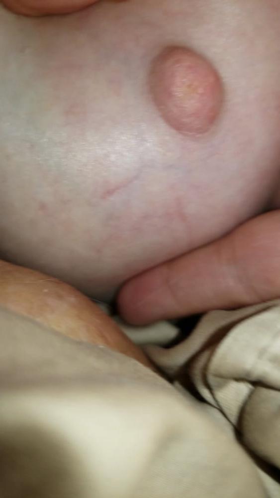 25P Ugly Pig Wife Chris shows her saggy boobs