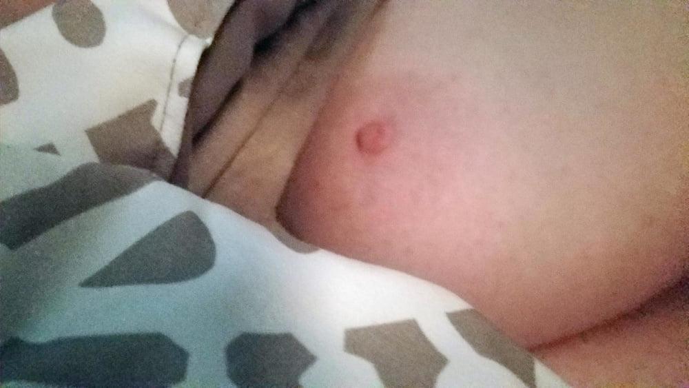 25P Ugly Pig Wife Chris shows her saggy boobs