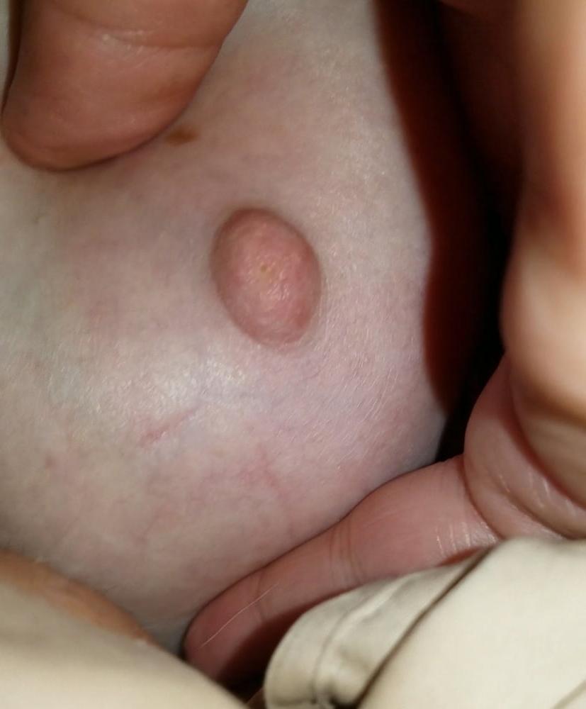 25P Ugly Pig Wife Chris shows her saggy boobs