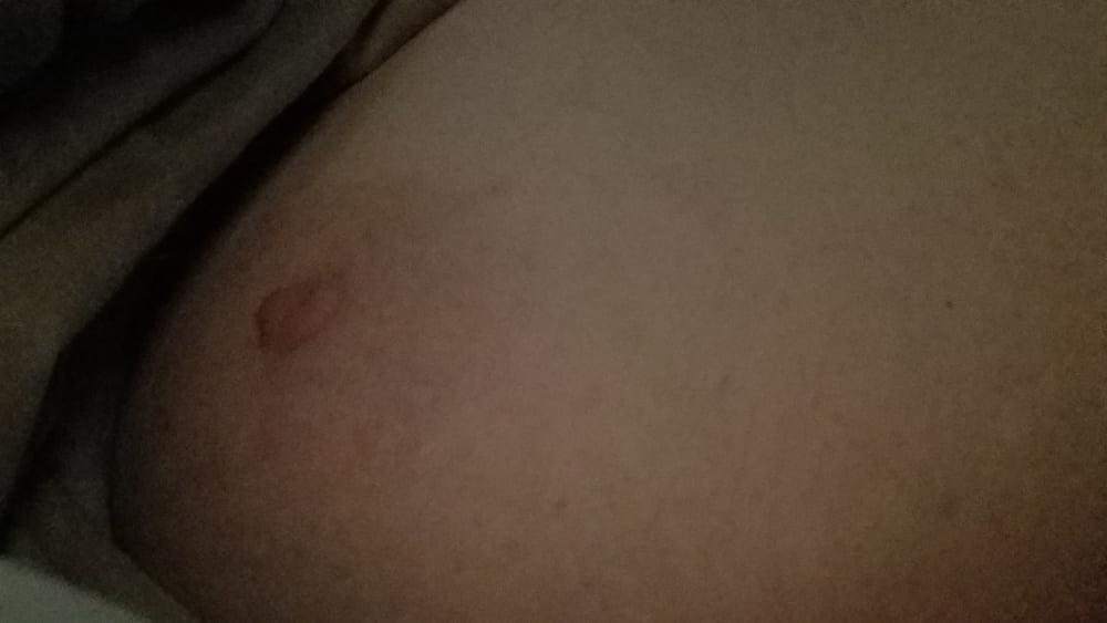 25P Ugly Pig Wife Chris shows her saggy boobs