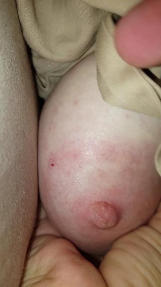 25P Ugly Pig Wife Chris shows her saggy boobs