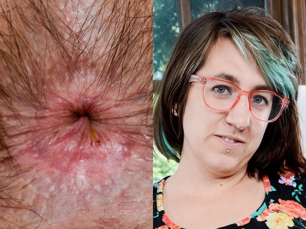 24P Face and Anus II