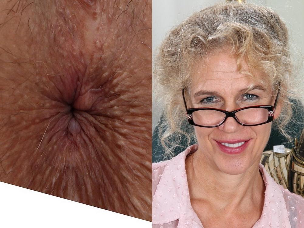 24P Face and Anus II