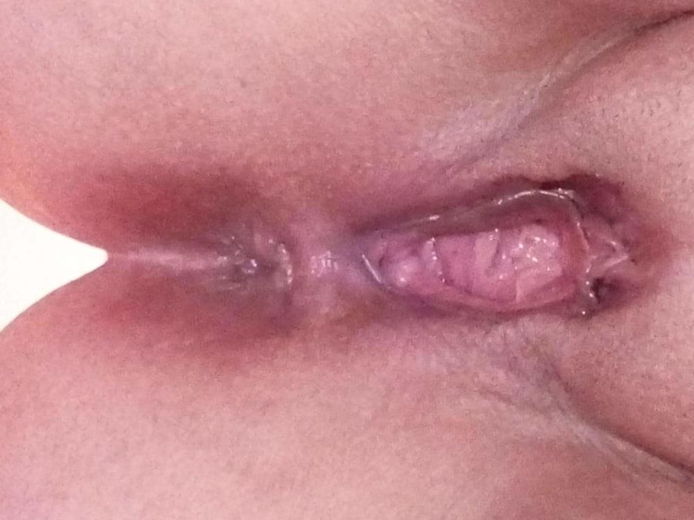 16P fat ass